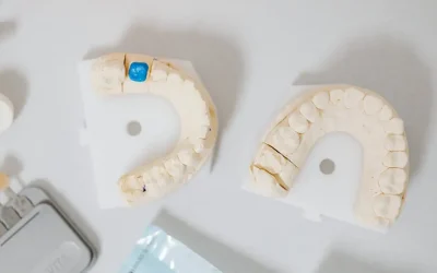 Exploring the Benefits of Custom Braces for a Perfect Smile